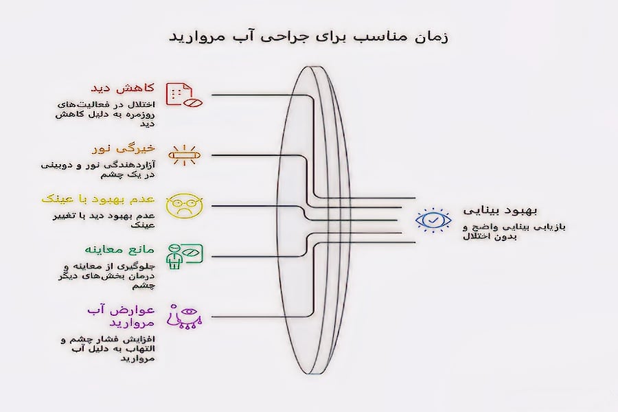 چه زمانی به فوق تخصص آب مروارید در تهران نیاز است؟