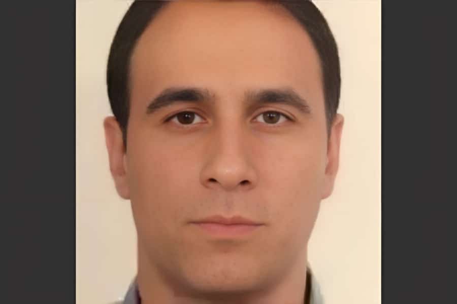 دکتر آپتین معبودی فوق تخصص ریه در کرج