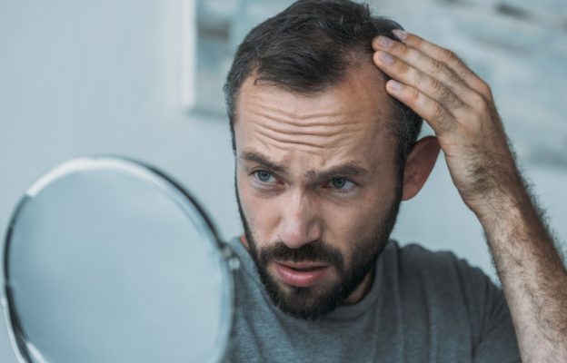 علت ریزش مو در مردان بالای ۴۰ سال