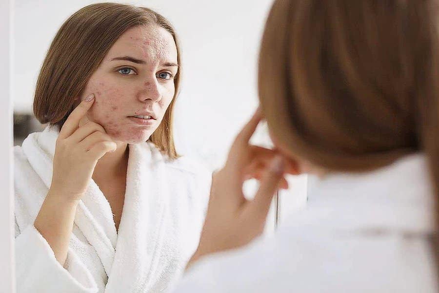 علائم اختلالات هورمونی