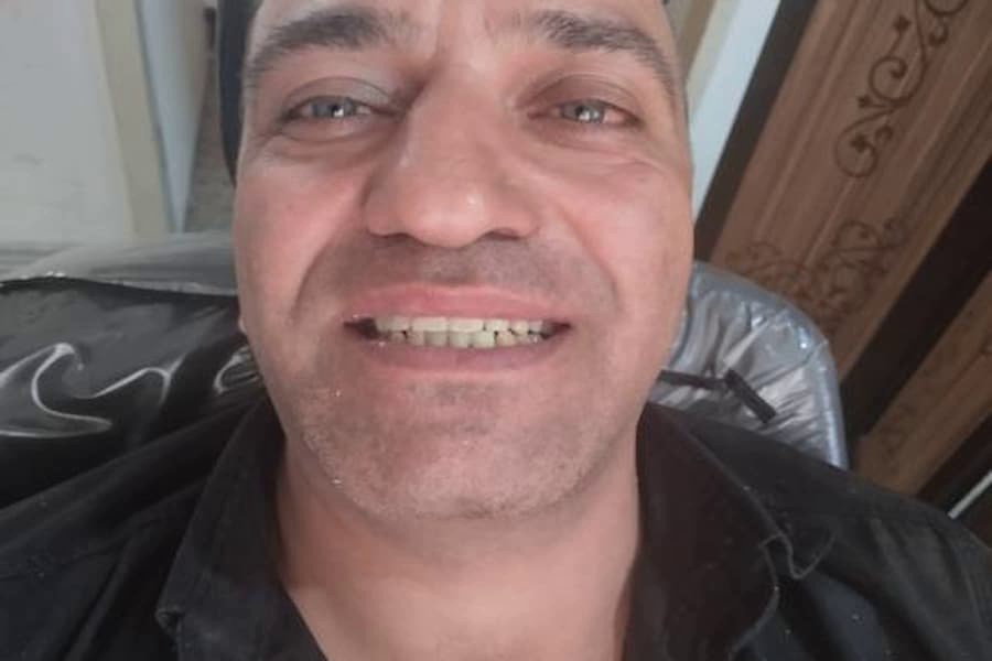 دندانسازی بصیری ساخت دندان مصنوعی در مشهد