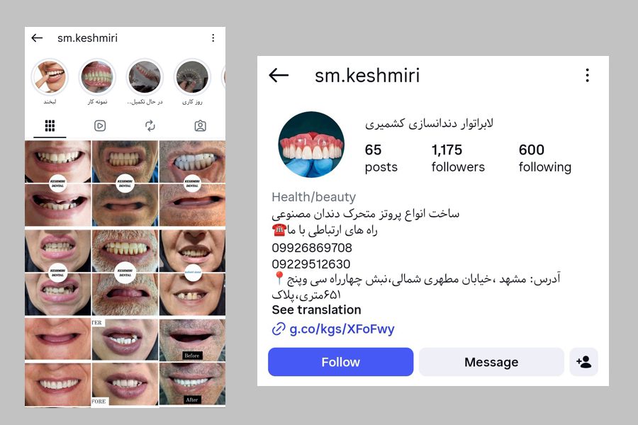 کشمیری دندانساز تجربی در مشهد