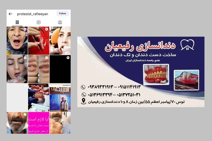 دندانسازی رفیعیان بهترین دندانساز تجربی در مشهد